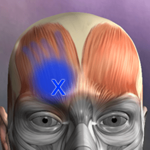 Muscle Trigger Point Anatomy 2.4.1